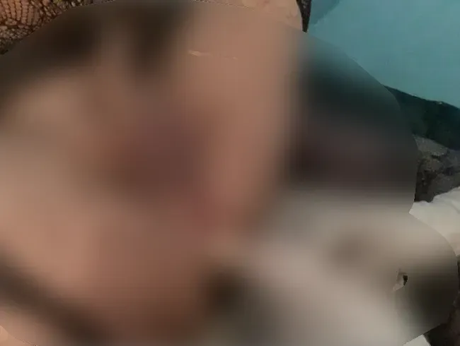 Die Sissy wird 2x zum Spritzen gebracht