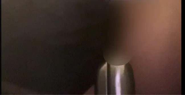 Mit dem Spekulum steht mein Loch weit offen