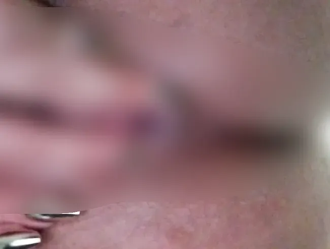 My destroyed holes after a Gangbang